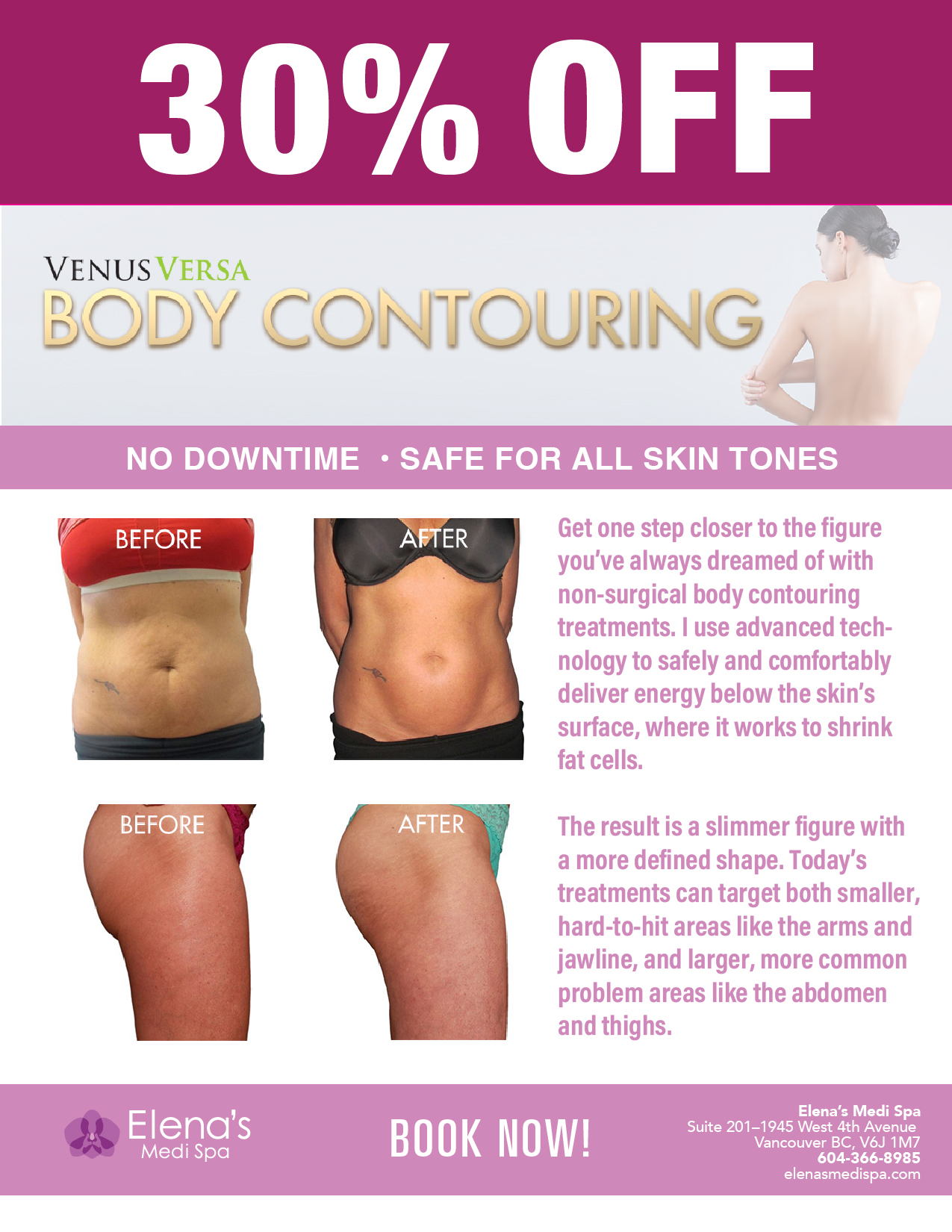 Ad for body contouring 30% off